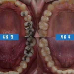 울산동구치과