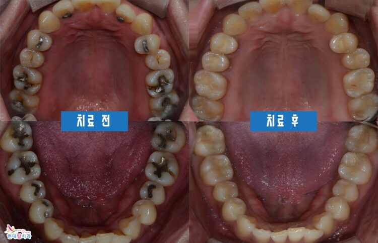 울산동구치과