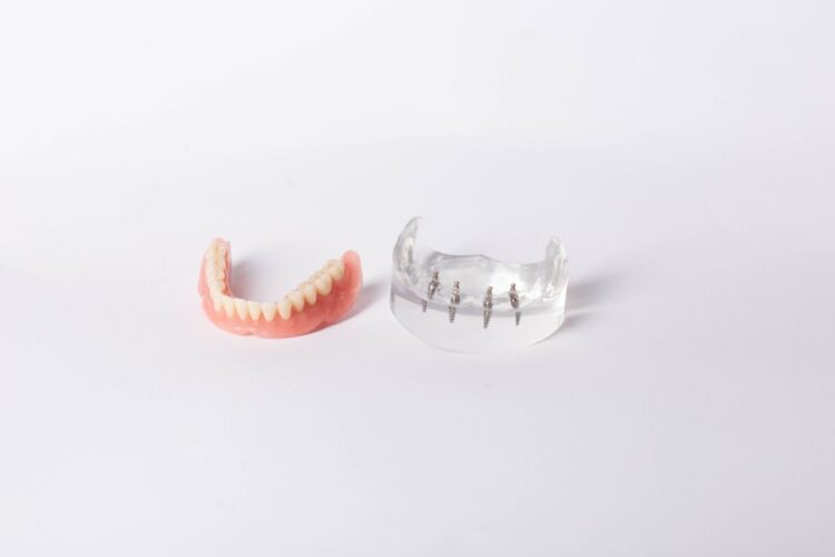 치아와 잇몸 약화로 울산틀니임플란트를 고려하는 상황