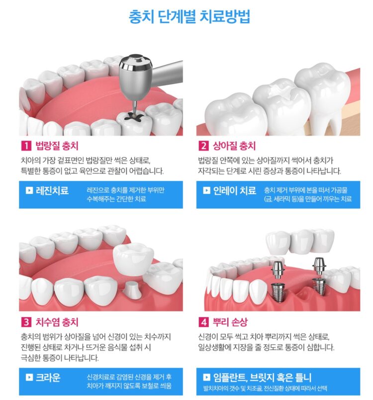 울산동구치과